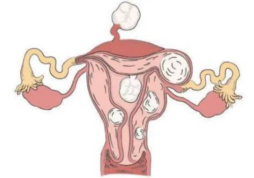 成都代怀生子机构：黄河三门峡医院试管婴儿医疗团队介绍，内附成功率及其费用明细！