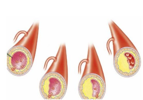 成都代怀公司：医生说宝宝趴着在暗示着什么，不能盲目分析